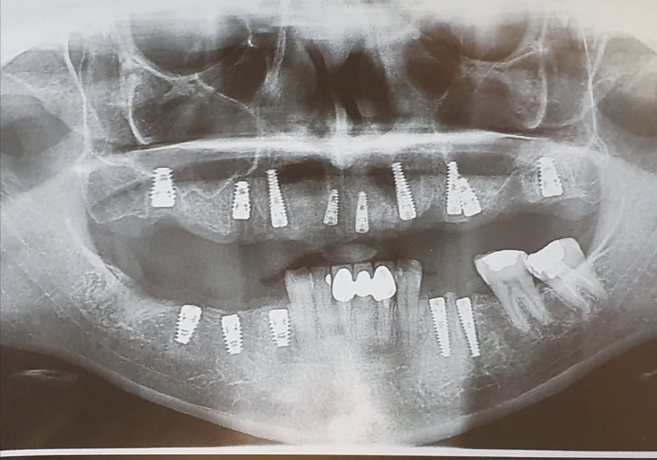 Zitouni Dental Clinic - صورة 3